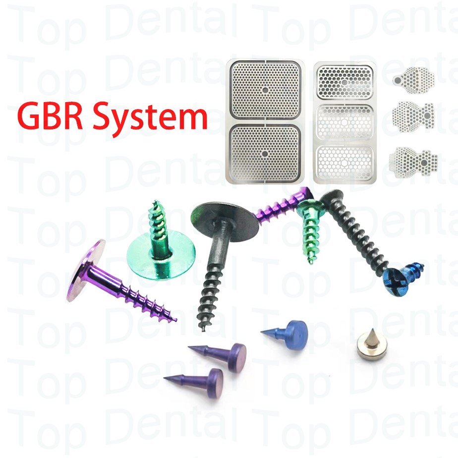 10pcs Dental GBR System Bone S – Stabilizer Screw In Bewertung und Preis