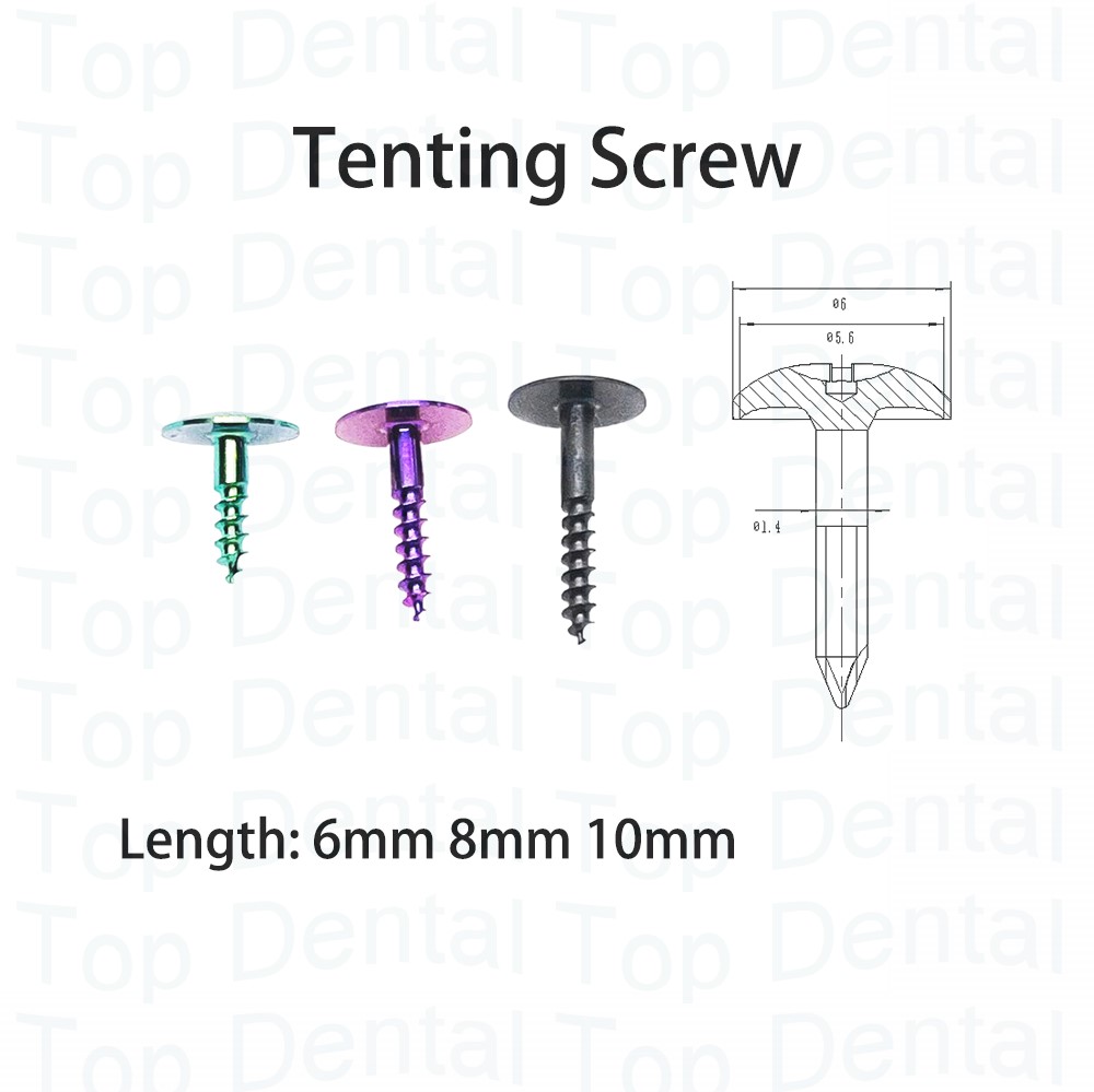 10pcs Dental GBR System Bone S – Stabilizer Screw In Bewertung und Preis