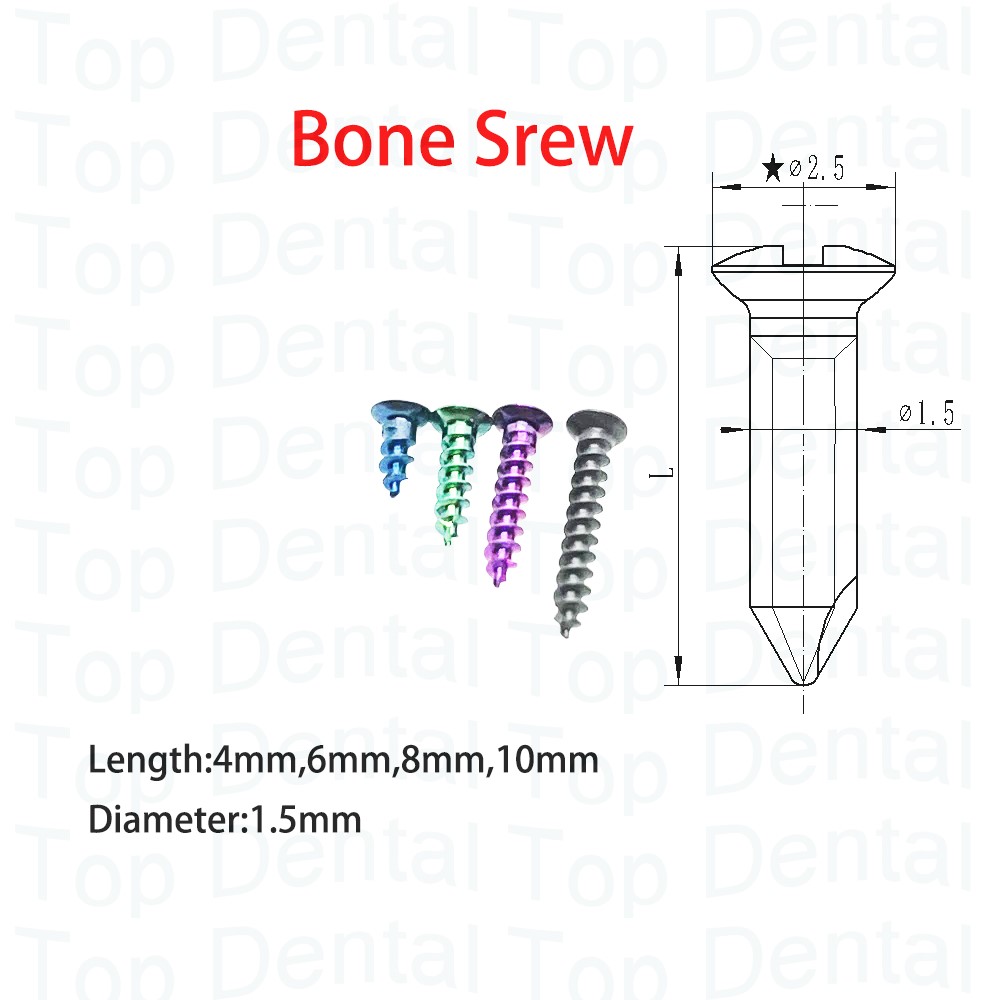 10pcs Dental GBR System Bone S – Stabilizer Screw In Bewertung und Preis
